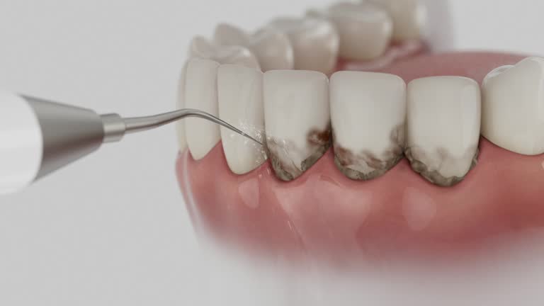 Trusted Teeth Cleaning And Checkup service in Madisonville, TX - Dentist Open Now